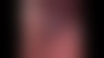 Laparoscopic Appendectomy for Subhepatic Appendix Vermiformis