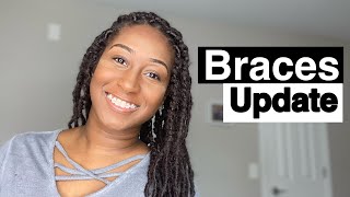 BRACES UPDATE (3 YEARS+) & TIGHTENING braces orthodontic