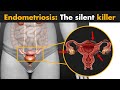 Endometriosis | What you need to know?