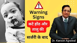 Warning Signs After Cleft Lip and Palate Surgery | Dr Karoon