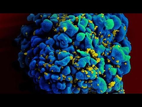 Video: Hvem Skapte AIDS-viruset? - Alternativt Syn