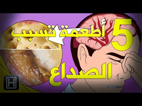 فيديو: ما هي الأطعمة التي يمكن أن تسبب الصداع