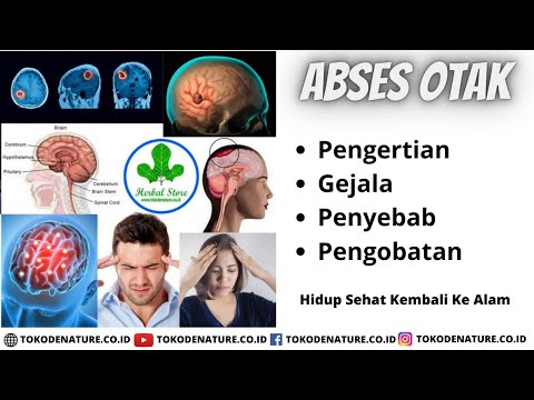 Abses Otak - Pengertian - Gejala - Penyebab - Pengobatan