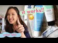 4 Step OILY, ACNE & BLACKHEAD Routine UNDER $50!