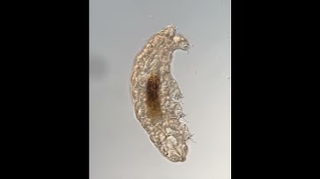 Tardigrade crawling at 400x magnification, big water bear!