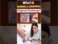 What is normal and abnormal white discharge? #shorts #trending#womensfertilitytips #irregularperiods