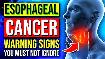 7 Causes & Warning Signs Of Esophageal Cancer You Must Not Ignore