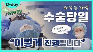 [강남그랜드안과] 라식 라섹 수술 전! 😲환자가 반드시 알아둬야 할 수술 중 주의사항 & 당일 절차