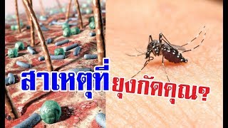 เคยสงสัยไหม ? ทำไมคุณถึงโดนยุงกัดมากกว่าคนอื่น - Mosquito bites