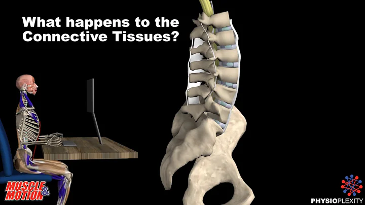 Prolonged sitting and back pain