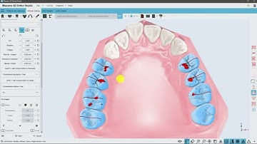 Maestro 3D | Dental Studio | Virtual Setup