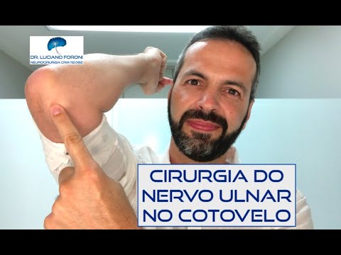 Vídeo: Captura Do Nervo Ulnar: Sintomas, Causas De Exercícios E Cirurgia