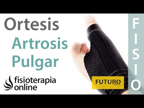 Artrosis del pulgar - Cómo, cuándo y por qué utilizar ortesis