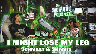 I Might Lose My Leg - Schmeat & Shamis | The Might Die Podcast - Episode 33
