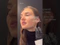 Does Jaw Botox Slim the Face? - Botox Cosmetic - Botox Jawline