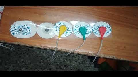 REAL TIME ECG USING MATLAB