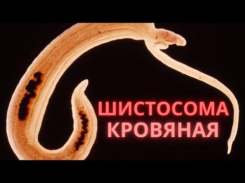 Видео: Что вызывает schistosoma haematobium?