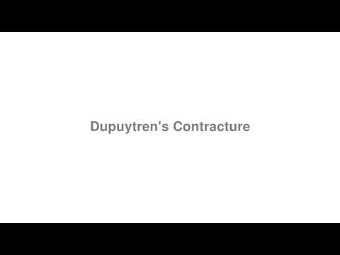 How to Pronounce "Dupuytren&rsquo;s Contracture"