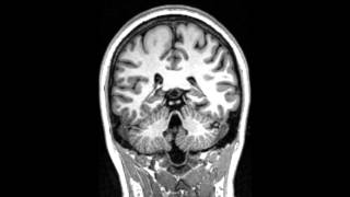 S-PAM - Brain Resolution