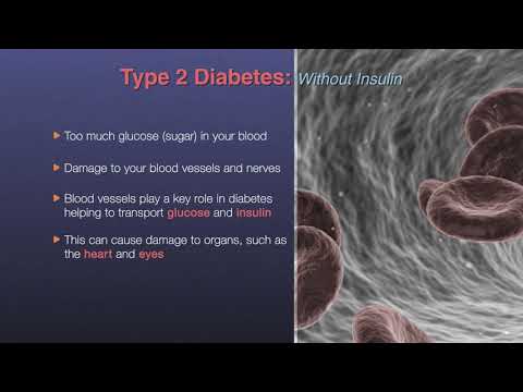 Type 2 Diabetes Part 1