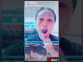 Fake Injury ( Tiktok) Glitch App