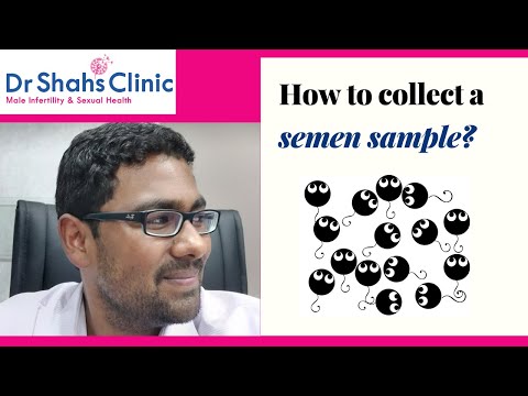 How to collect semen sample ? 10 points to remember during seminal fluid analysis (2020)