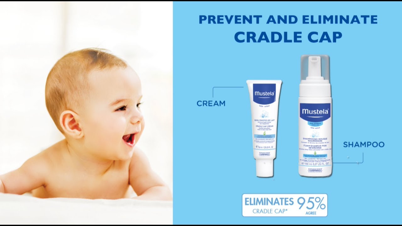 mustela baby cradle cap cream