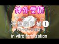 【不妊治療①-2】体外受精/はじめての胚移植/移植後から判定日まで/判定結果