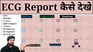 How to Read ECG | ECG Report Kaise Dekhe | ECG Report Kaise Check Kare | Normal & Abnormal