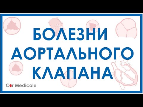 Видео: Каква аортна полулунна клапа?