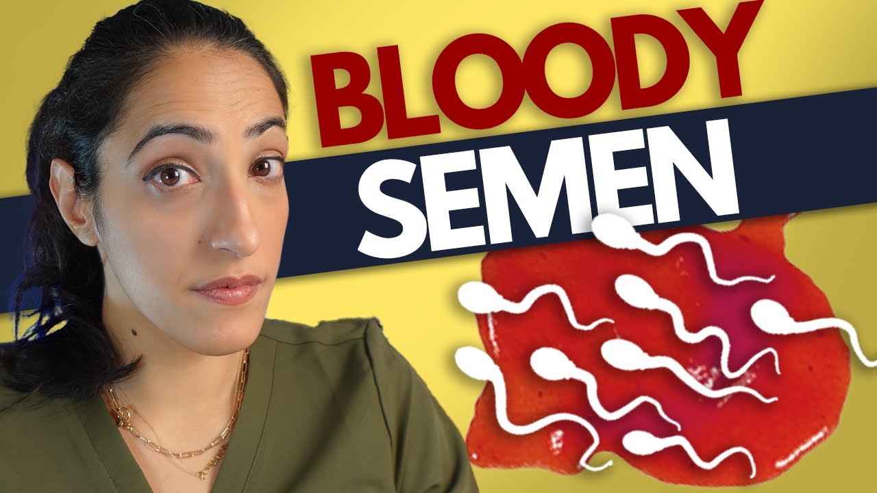 Should You Worry About Blood In Your Semen Hematospermia YouTube