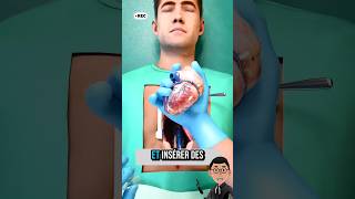 🤔Comment s'effectue une opération Cardiaque ? #france #canada #science #doctor #heart #heartsurgery
