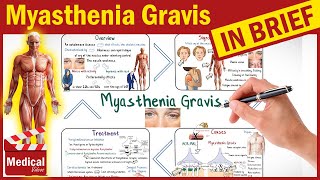 Myasthenia Gravis Symptoms, Causes, Treatment, Pathophysiology | What is Myasthenia Gravis?