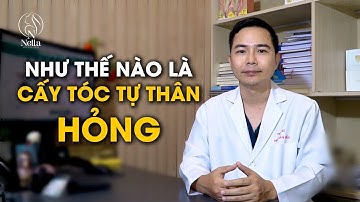 Như thế nào là 1 ca Cấy tóc tự thân hỏng?