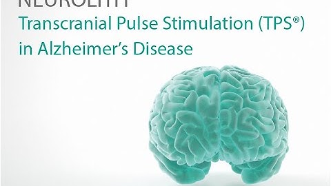 Transcranial Pulse Stimulation – A modern therapeutic procedure for treating Alzheimer’s symptoms