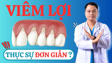 VIÊM LỢI CÓ THỰC SỰ ĐƠN GIẢN? |Dr Cường Offical