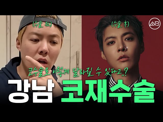 강남도 피할 수 없었던 코 재수술, 진짜 필수인가요? | 에이비성형외과