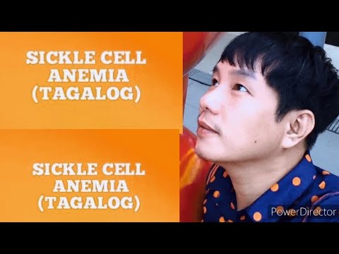 SICKLE CELL ANEMIA (Tagalog)