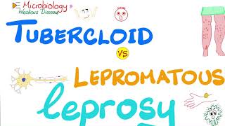 Tuberculoid Leprosy vs Lepromatous Leprosy | Comparisons Playlist