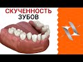 СКУЧЕННОСТЬ и ИЗБЫТОЧНЫЙ НАКЛОН зубов | Почему зубам не хватает места и что с этим делать?