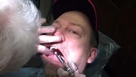 tooth extraction anesthesia