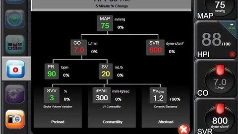 16🤖 HPI - Predicting the Blood Pressure Drop: 🩺How AI is Changing Perioperative Care 💉⚡