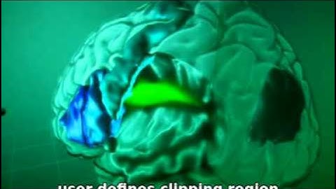 Visualization of Probabilistic Fiber Pathways in Virtual Reality