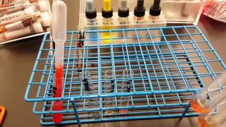 Blood Banking: ABO&D testing Part 2 Result Interpretation