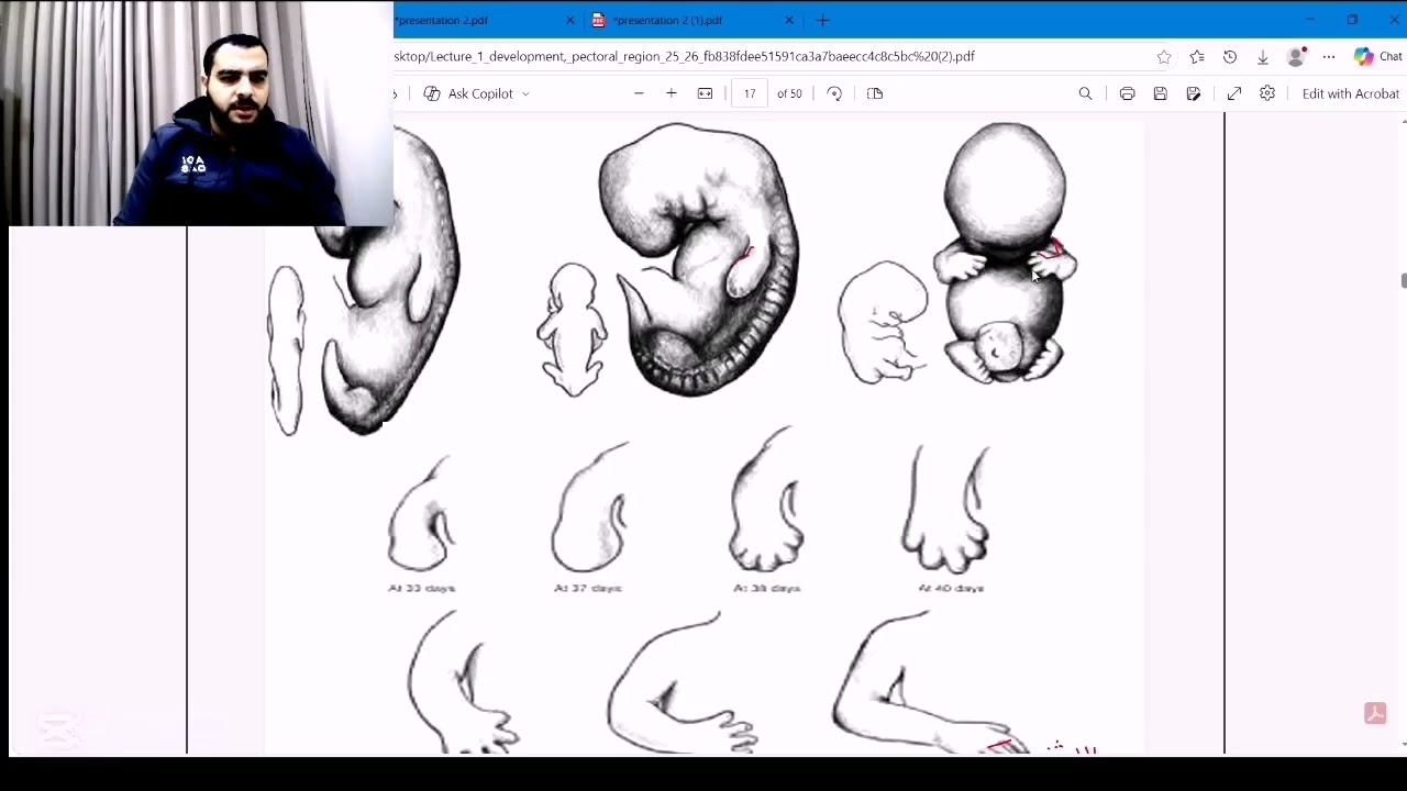 1-Anatomy - MSK - limp develoment & congenital anomalies (menofia)