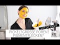 PICKEL? GROßE POREN? PIGMENTFLECKEN? Diese SOS DIY Maske mit Kurkuma hilft! | Sheila Gomez