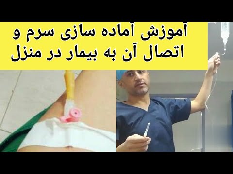 تصویری: نحوه آماده سازی برای برداشتن بریس ها: 12 مرحله