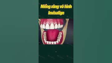 [3D] Invisalign - Niềng răng vô hình || Nha Khoa Quốc Tế Athena