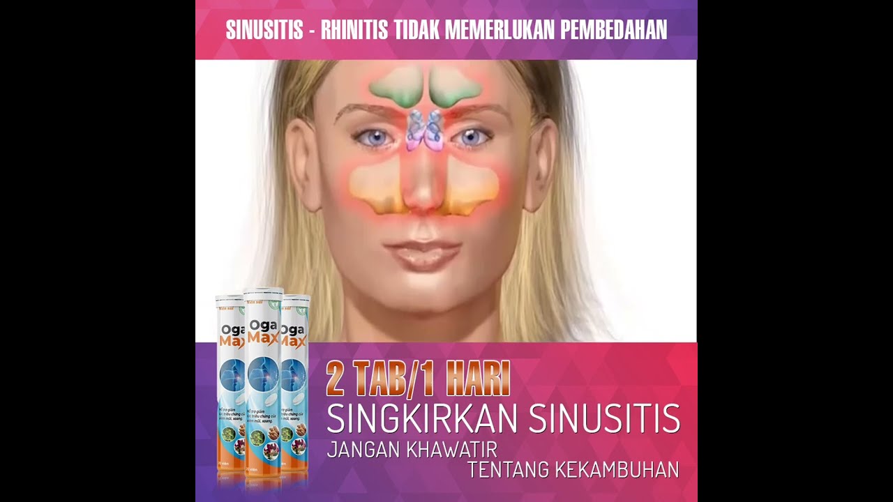 Cara mengobati sinusitis 