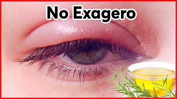 ¿Cómo se secan los ojos después de llorar?